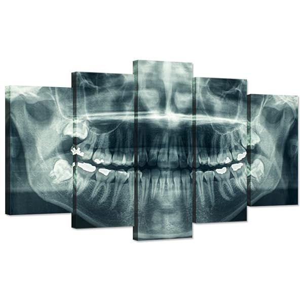 Modern 5 Panel Canvas Wall Art: X-Ray Dental Tooth Print for Dental Rooms & Living Spaces - Ready to Hang!