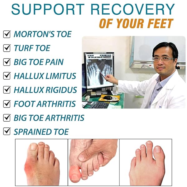 Morton's Extension Orthotic Carbon Fiber Insole Rigid Foot Support Insert for Morton's Toe Turf Toe Hallux Rigidus Arthritis Men Size 11 Women 12 - Image 6